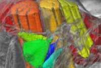 QUANTIM Hackathon: 3D visual annotations