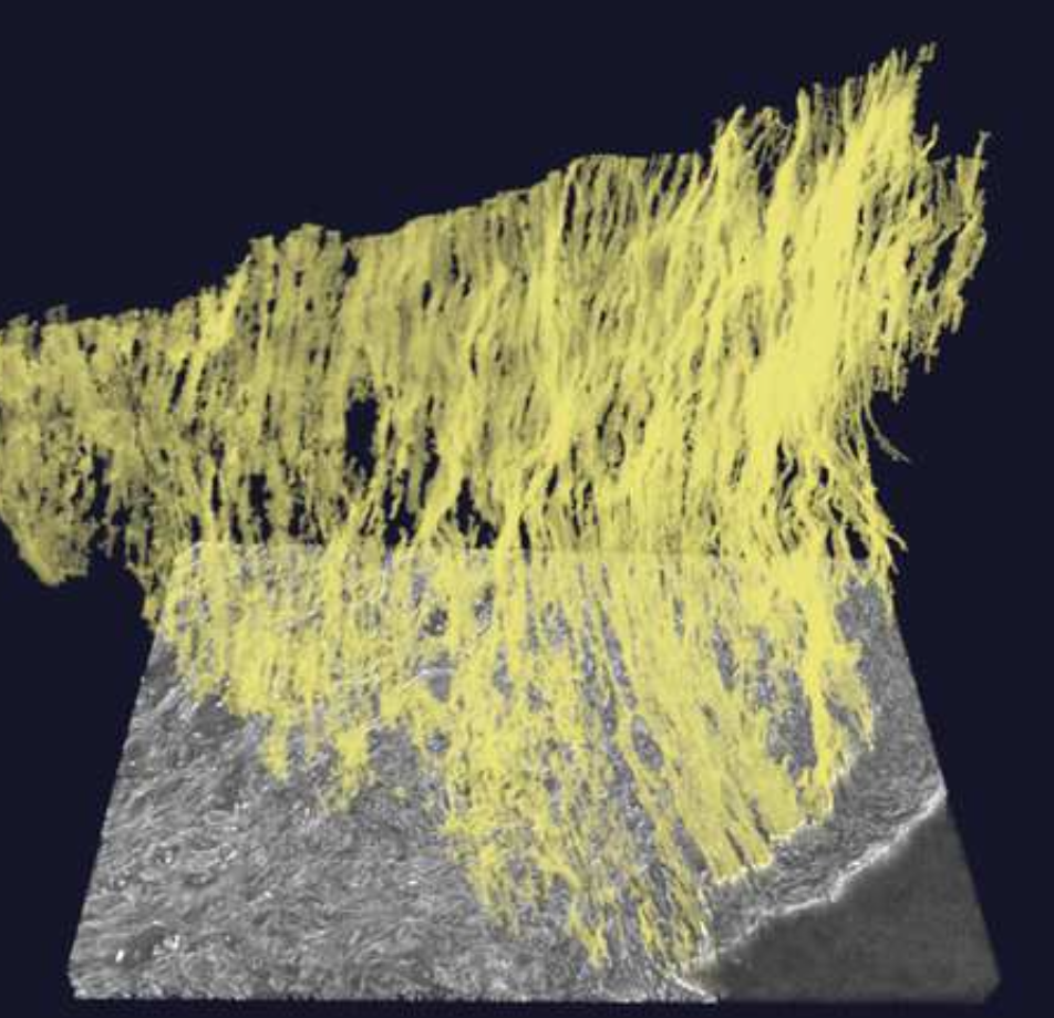 Figure caption: 3D rendering of internal elastic membrane in vessel wall of human atherosclerotic plaque.